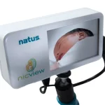 What is NICVIEW?