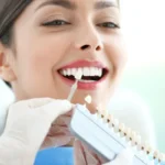 Dental Veneers For Missing Teeth