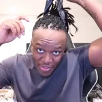 KSI Forehead
