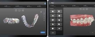 Nerovet ai dentistry 